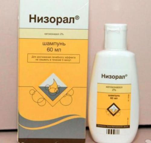 Как быстро убрать перхоть. Рецепты от читательниц 02