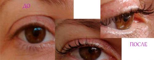 Касторовое масло для ресниц. Польза касторового масла для ресниц и бровей