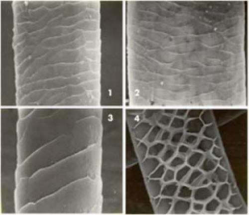 Что такое волосы человека. Волос человека: химический состав 05