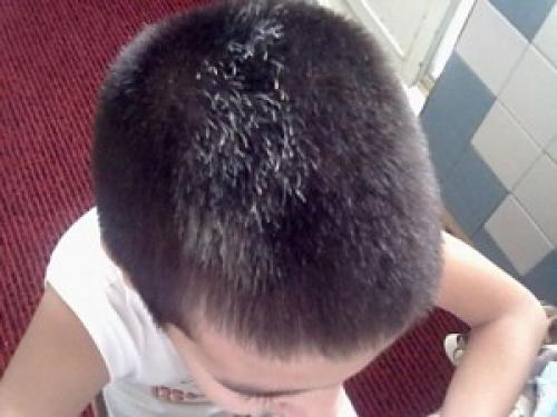 Седые волосы в раннем возрасте. В каком возрасте появляется первая седина 02