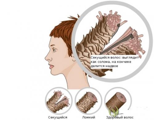 Полировка секущихся кончиков. Суть процедуры