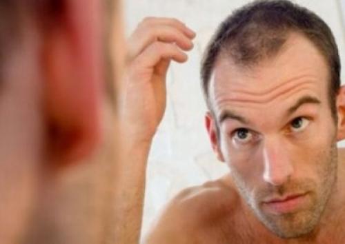 Как убрать перхоть у мужчин. Лечение перхоти у мужчин