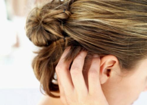 Дерматолог лечение перхоти. Лечение народными средствами