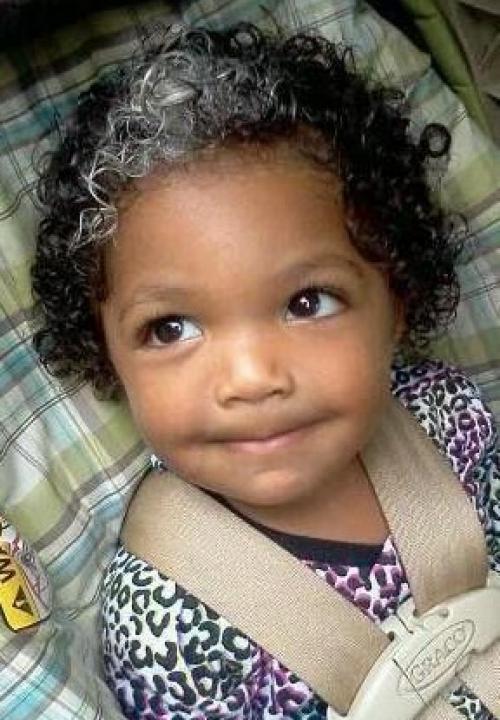 Седые волосы у годовалого ребенка. ПРИЧИНЫ СЕДЫХ ВОЛОСЫ У ДЕТЕЙ