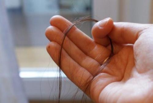 Могут ли умереть волосяные луковицы. Что делать, если волосы выпадают с луковицей? Вырастут ли они снова? 01 Могут ли умереть волосяные луковицы. Что делать, если волосы выпадают с луковицей? Вырастут ли они снова? 01