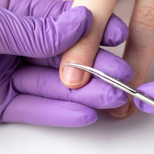 Почему гель-лак слезает пленкой. Почему гель-лак не держится на ногтях?