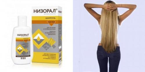 Сделать волосы густыми редкие волосы. Лечебные средства