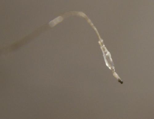 Слабые луковицы волос, что делать. Норма или болезнь?