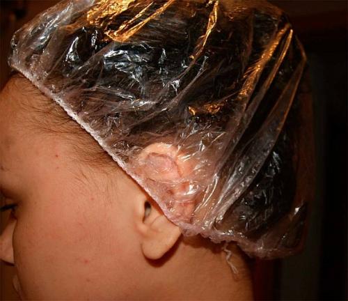 Как исправить редкие волосы. Местное лечение и оздоровление