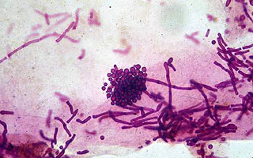 Можно ли взрослым использовать детский шампунь. Можно ли мыть голову детским шампунем взрослым? 15