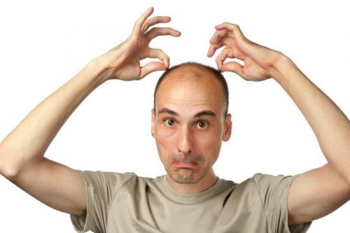 Алопеция заразна. Ген облысения – причина в наследственности