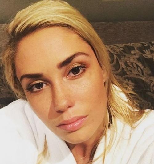 Жидкие волосы у звезд. Четыре блондинки в российском шоу-бизнесе, у которых тонкие жидкие волосы