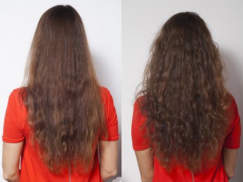 Редкие волосы спереди. Редкие волосы: что делать?