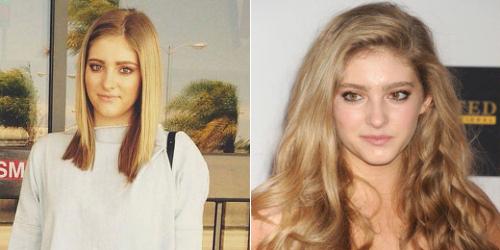 Редкие волосы спереди. Редкие волосы: что делать?