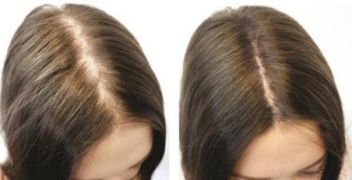 От какого шампуня волосы быстро растут. Полезные составляющие 04 От какого шампуня волосы быстро растут. Полезные составляющие 04