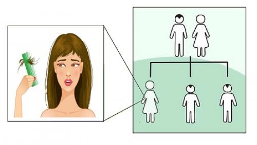 Причина выпадения волос на голове у девушки. Виды выпадения волос (алопеции) 03 Причина выпадения волос на голове у девушки. Виды выпадения волос (алопеции) 03