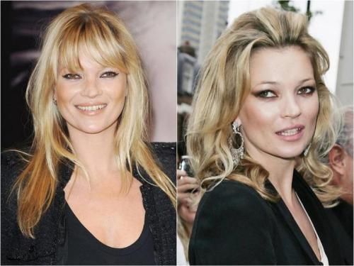 Что делать редкие волосы. Салонные процедуры для редких волос 04 Что делать редкие волосы. Салонные процедуры для редких волос 04