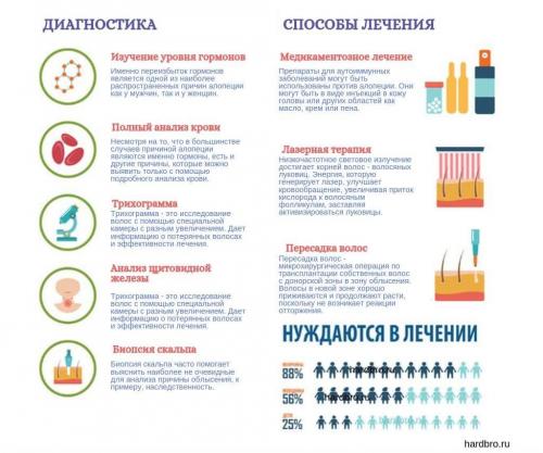 Причины выпадения волос у мужчин. Как остановить облысение