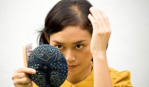 Причины выпадение волос у девушки. Причины выпадения волос у девушек в 15 лет 01