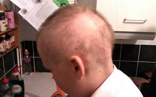 Очень редкие волосы у ребенка. Выпадение волос у новорожденных