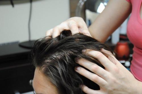 Как избавиться от перхоти. Рекомендации трихологов: как раз и навсегда избавиться от перхоти