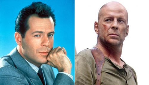 Почему выпадают волосы у мужчин. Почему выпадают волосы, а мужчины лысеют чаще, чем женщины?