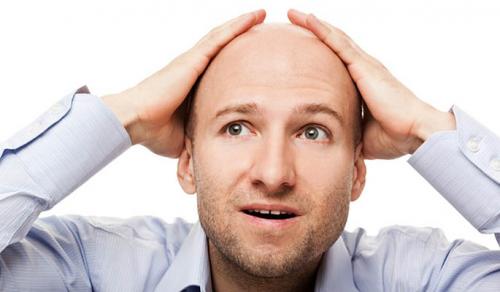 Почему выпадают волосы у мужчин. Причины выпадения волос у мужчин