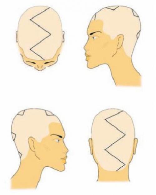 Мелирование колорирование омбре. ШАТУШ, БАЛАЯЖ, ОМБРЕ, БРОНДИРОВАНИЕ - ЧЕМ ОТЛИЧАЮТСЯ И КАК ВЫБРАТЬ ОКРАШИВАНИЕ ДЛЯ СЕБЯ 05