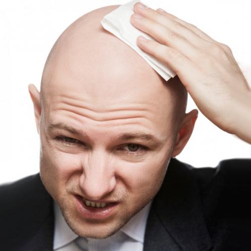 Как остановить выпадение волос у мужчин. 7 Способы лечения мужского облысения