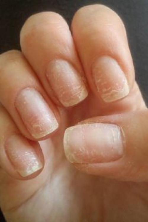 Гель-лак отслаивается пленкой. Почему отслаивается гель-лак от ногтей: причины и особенности