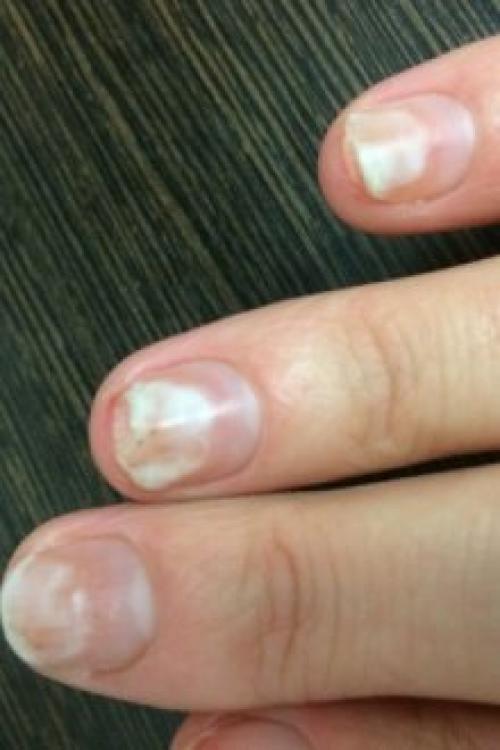 Гель-лак отслаивается пленкой. Почему отслаивается гель-лак от ногтей: причины и особенности