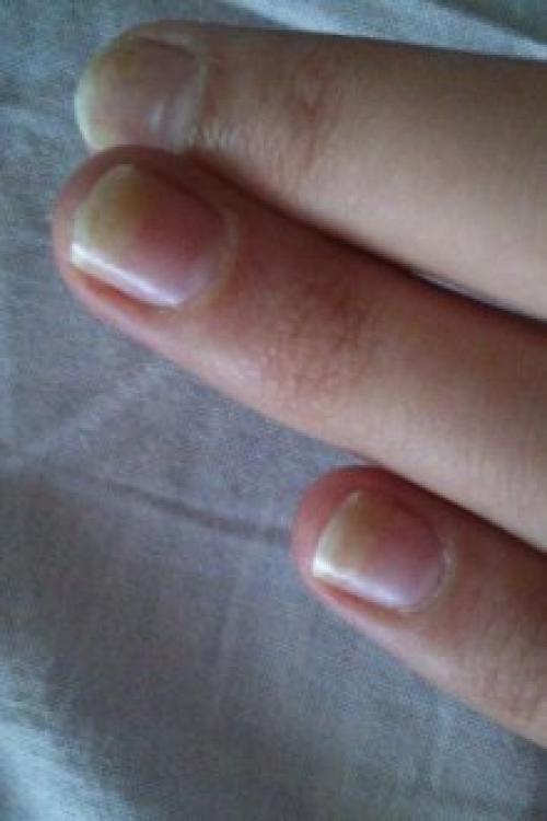 Гель-лак отслаивается пленкой. Почему отслаивается гель-лак от ногтей: причины и особенности