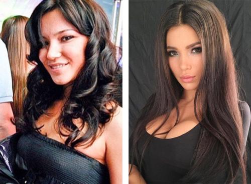 Звезды Инстаграм до и после пластики. 12 российских звезд Instagram до и после пластики! Не узнать! 11