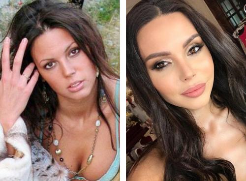 Звезды Инстаграм до и после пластики. 12 российских звезд Instagram до и после пластики! Не узнать! 05