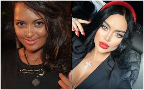 Patricia lynx до пластики. Все ради славы: 15 звезд Инстаграм до и после пластических операций