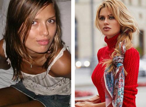 Звезды Инстаграм до и после пластики. 12 российских звезд Instagram до и после пластики! Не узнать! 02