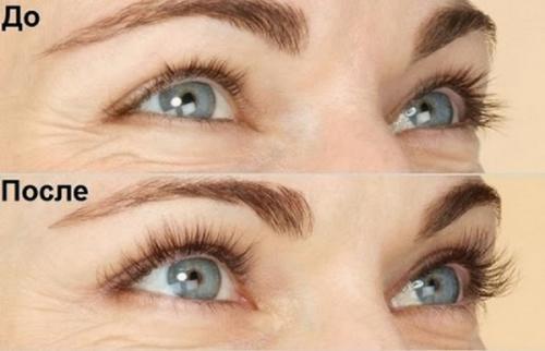 Касторовое масло или репейное, что лучше для ресниц. Касторовое или репейное масло: какое лучше для укрепления ресниц и бровей 15