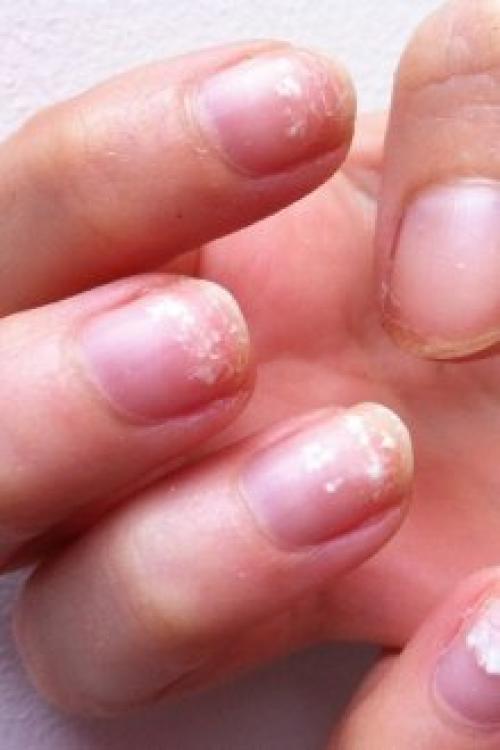 Гель-лак отслаивается пленкой. Почему отслаивается гель-лак от ногтей: причины и особенности