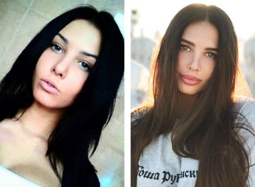 Звезды Инстаграм до и после пластики. 12 российских звезд Instagram до и после пластики! Не узнать! 06