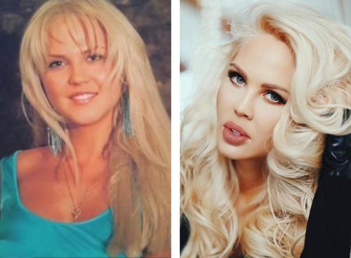 Звезды Инстаграм до и после пластики. 12 российских звезд Instagram до и после пластики! Не узнать! 07