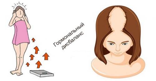 У девушки выпадают волосы, что делать. Выпадение волос у женщин – причины, лечение сильного выпадения 02 У девушки выпадают волосы, что делать. Выпадение волос у женщин – причины, лечение сильного выпадения 02
