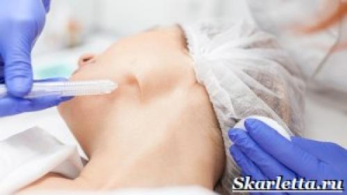 Газожидкостный ПИЛИНГ цены. Газожидкостный ПИЛИНГ. Описание, особенности, виды и цена газожидкостного пилинга