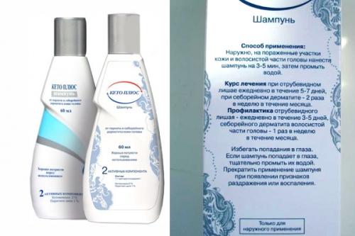 Как очистить волосы от перхоти. Как избавиться от перхоти на голове быстро, просто и навсегда? 11