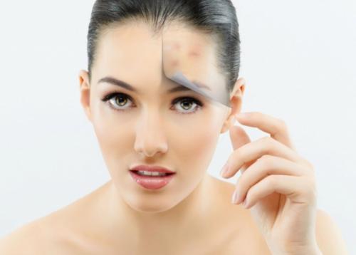 Маски от жирного блеска на лице. Домашние маски против жирного блеска: как сделать матовое лицо в жару