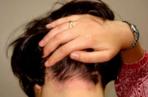 Дегтярное мыло чем полезно для волос. Дегтярное мыло для волос – панацея от серьезных проблем 13