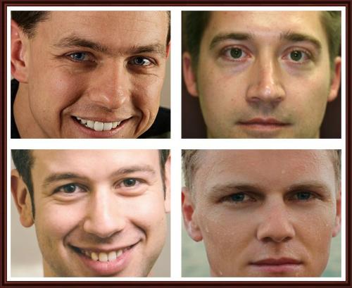 Как избавиться от мешков под глазами у мужчин. Причины патологии