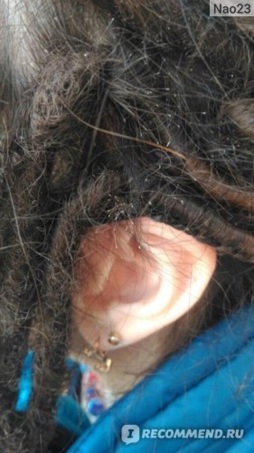 Де-дреды. Уникальность,красота,внимание окружающих(много фото)