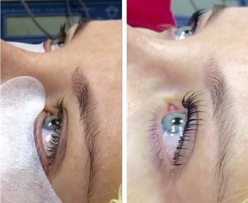 Ламинирование ресниц —, что это за процедура