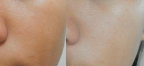 Маска отбеливающая в домашних условиях. Самые популярные ингредиенты масок, обладающие осветляющими качествами