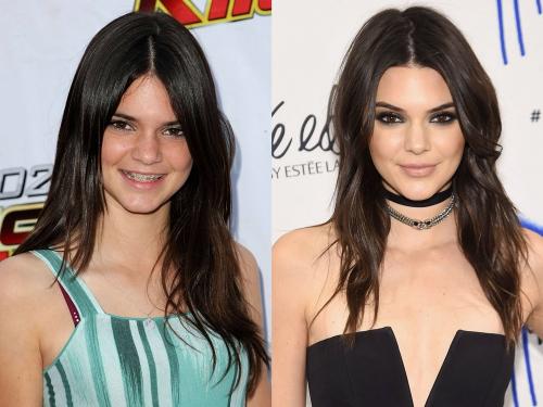 Как из простушки стать красоткой. Из простушки – в красавицу: школьные фото самых знаменитых супермоделей